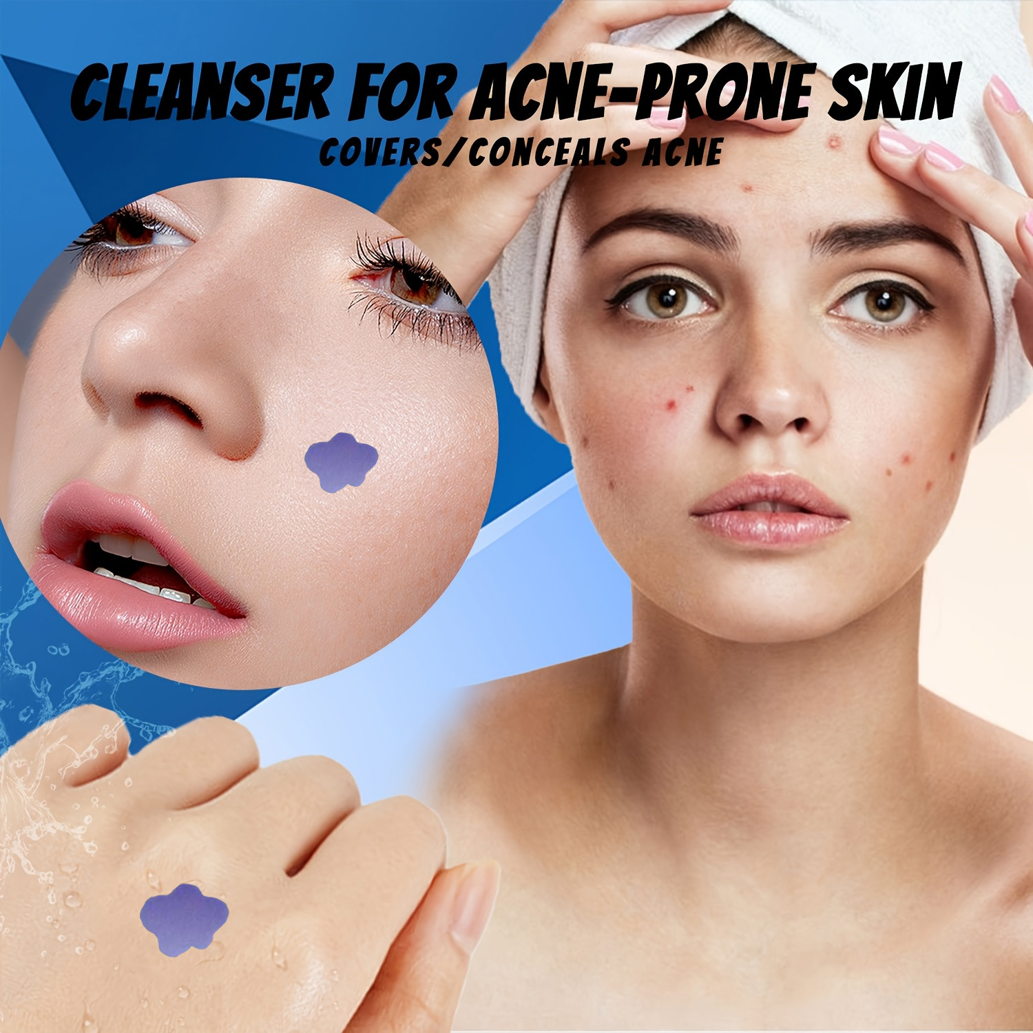 แผ่นแปะสิวไมโครนีดเดิล 232 ชิ้ - Skincare บทวิจารณ์และราคา