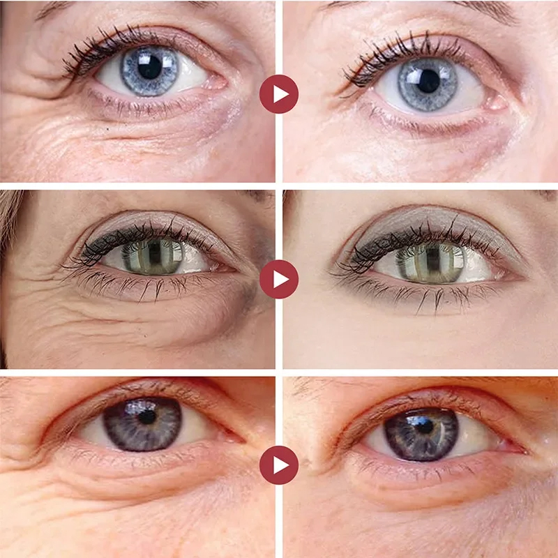 แผ่นแปะลดริ้วรอยรอบดวงตา ยกกระ - Collagen Under Eye Patches บทวิจารณ์และราคา